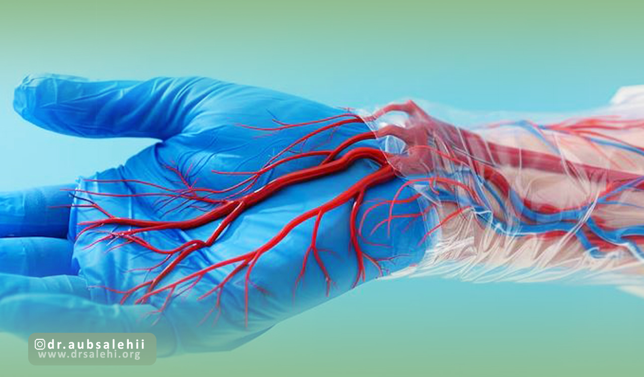 دلایل انجام آنژیوگرافی